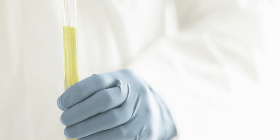 ACS Nano：突破！科学家利用来自尿液的生物标志物进行早期癌症筛查